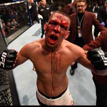 Live Chat Nate Diaz Conor McGregor UFC 2